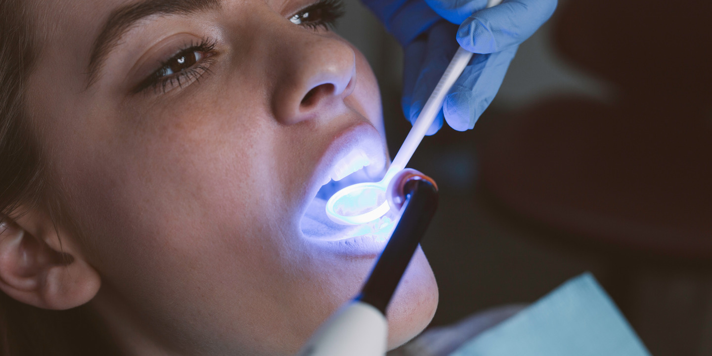 Frau mit geöffnetem Mund bei Zahnbehandlung