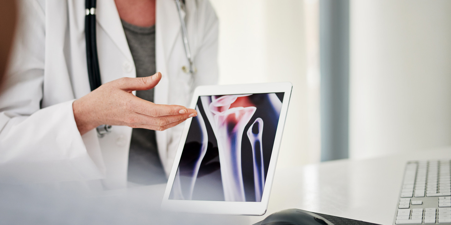 Ärztin erklärt Patient Röntgenbild auf Tablet. 