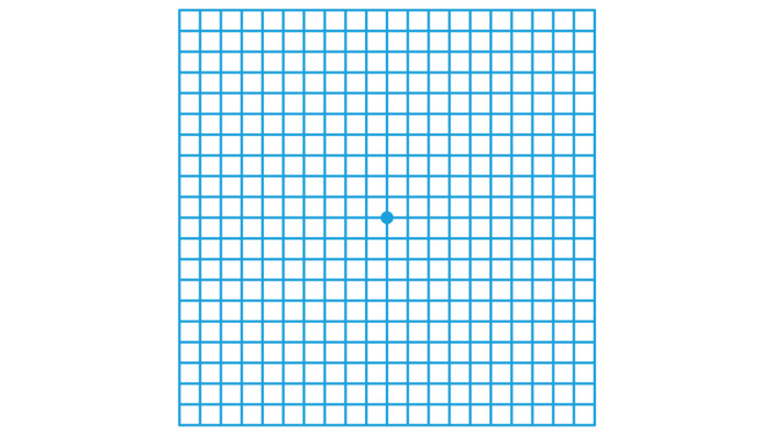 Das Amsler-Gitter