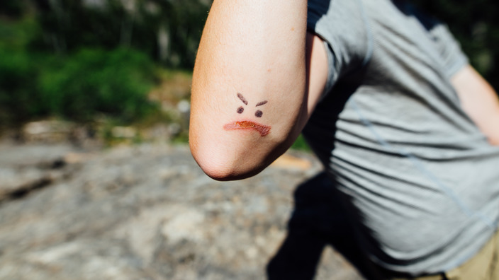 Teenager hat eine Verletzung am Ellenbogen mit schwarzem Filzstift so dekoriert, sodass sie aussieht wie ein zorniges Gesicht