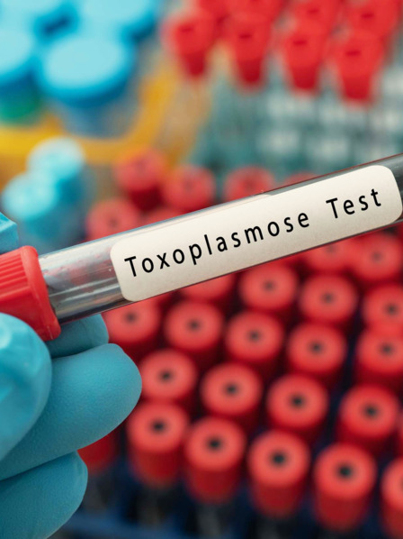 Blutgefäß für einen Toxoplasmose-Test