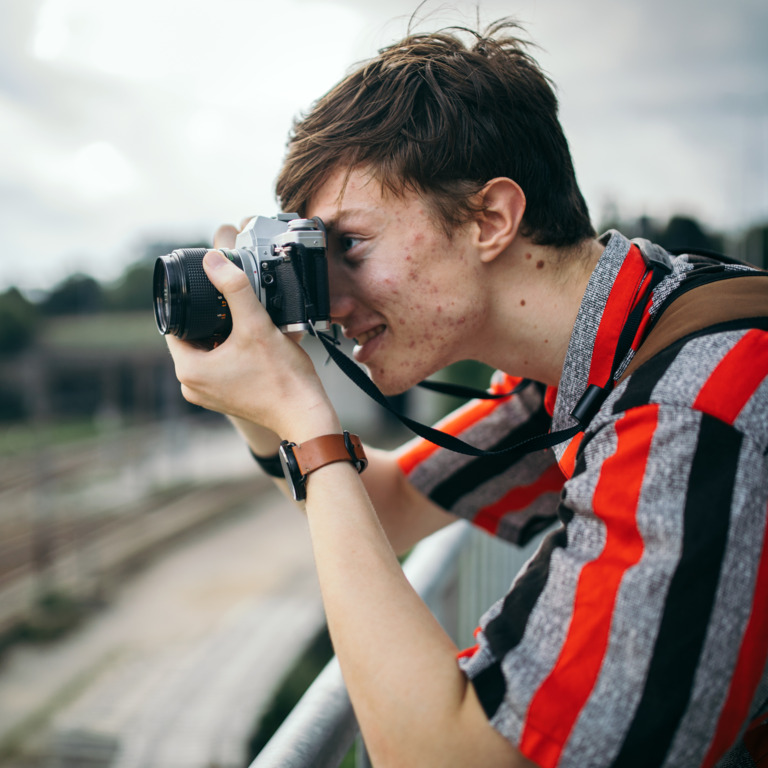 Junger Mann mit Pickeln im Gesicht fotografiert mit einer Kamera