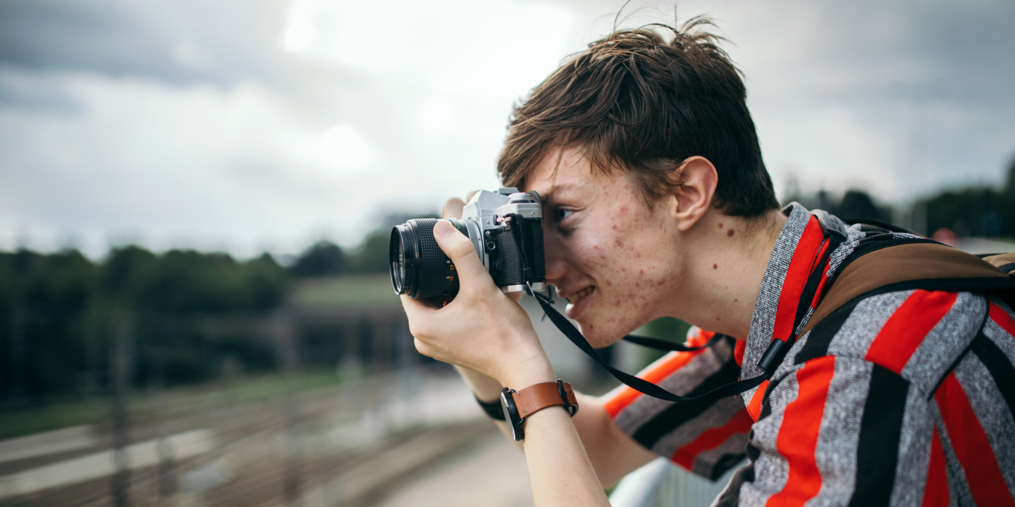 Junge mit Akne fotografiert