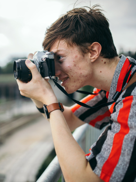Teenager mit Hautunreinheiten fotografiert etwas
