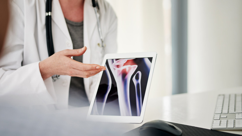 Ärztin erläutert einer Patientin Osteoporoseschäden am Knochen anhand einer Grafik auf dem Tablet