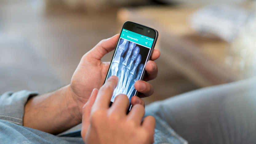 Mann schaut Röntgenaufnahme eines Fußes auf dem Smartphone an