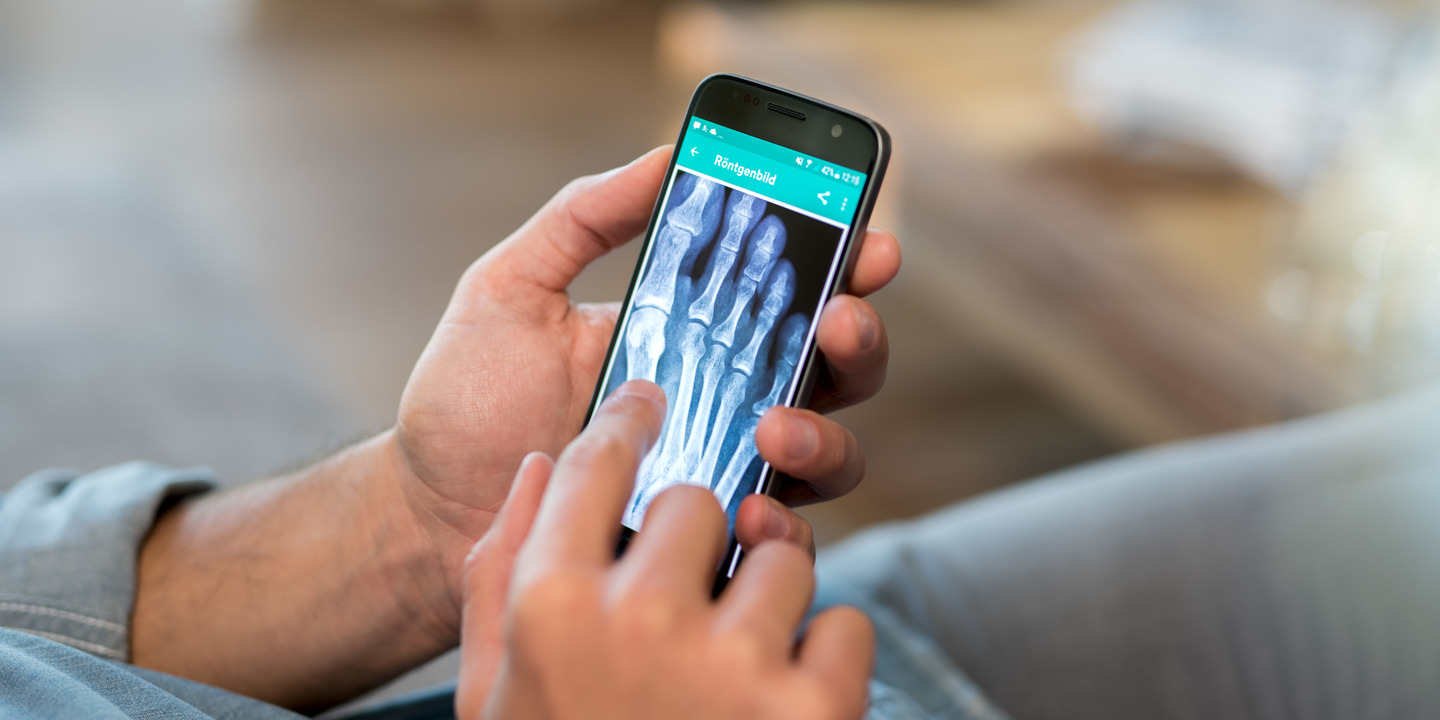 Männerhände hält Smartphone mit Röntgenbild auf Bildschirm.