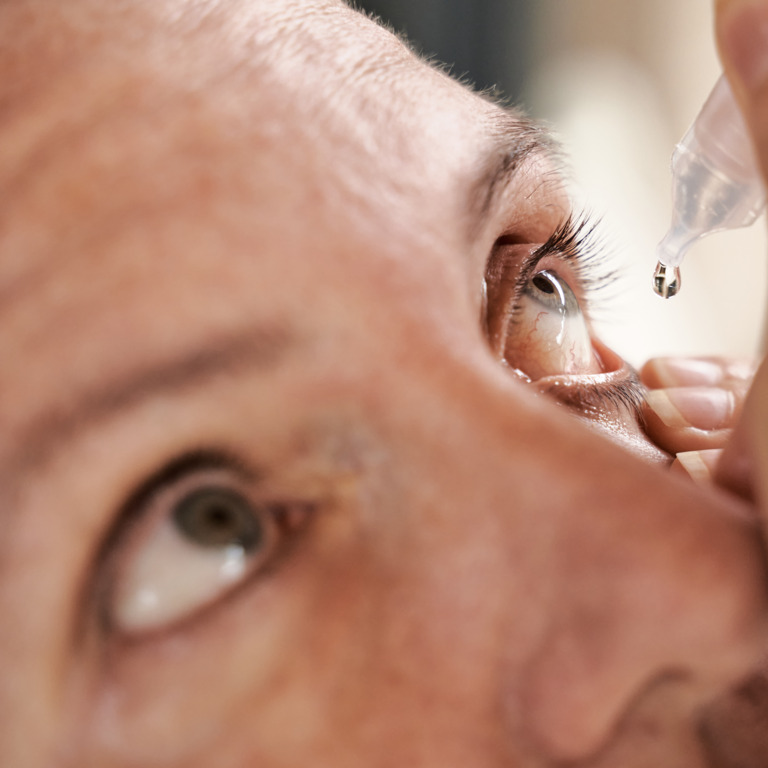 Ein Mann tropft sich Feuchtigkeitstropfen für die Bindehaut ins Auge.