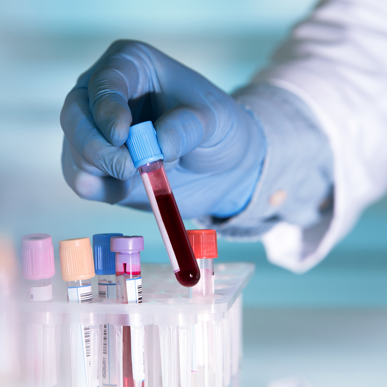 Person mit blauem Gummihandschuh ordnet Blutprobe im Labor ein
