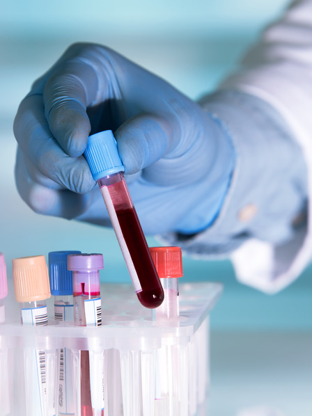 Labormitarbeiter sortiert Blutproben