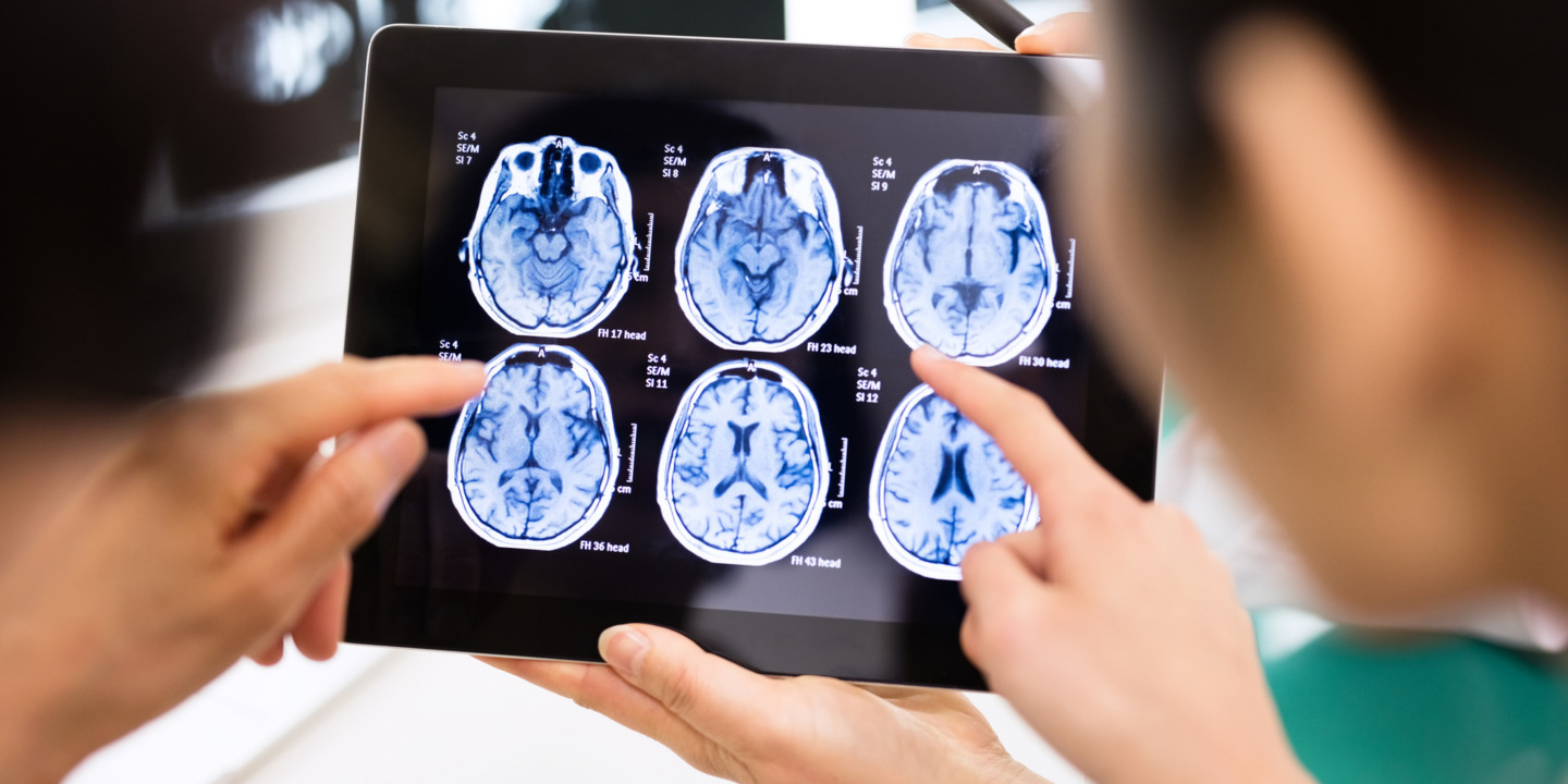 Ärzte schauen sich auf dem Tablet MRT-Ergebnisse des Gehirns eines Patienten an.