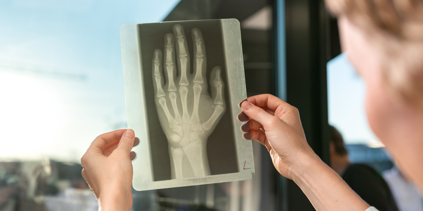 Ärztin betrachtet die Röntgenaufnahme einer Hand