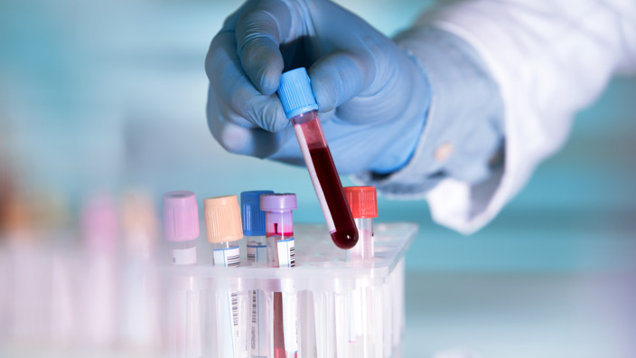 Labormitarbeiter sortiert Blutproben