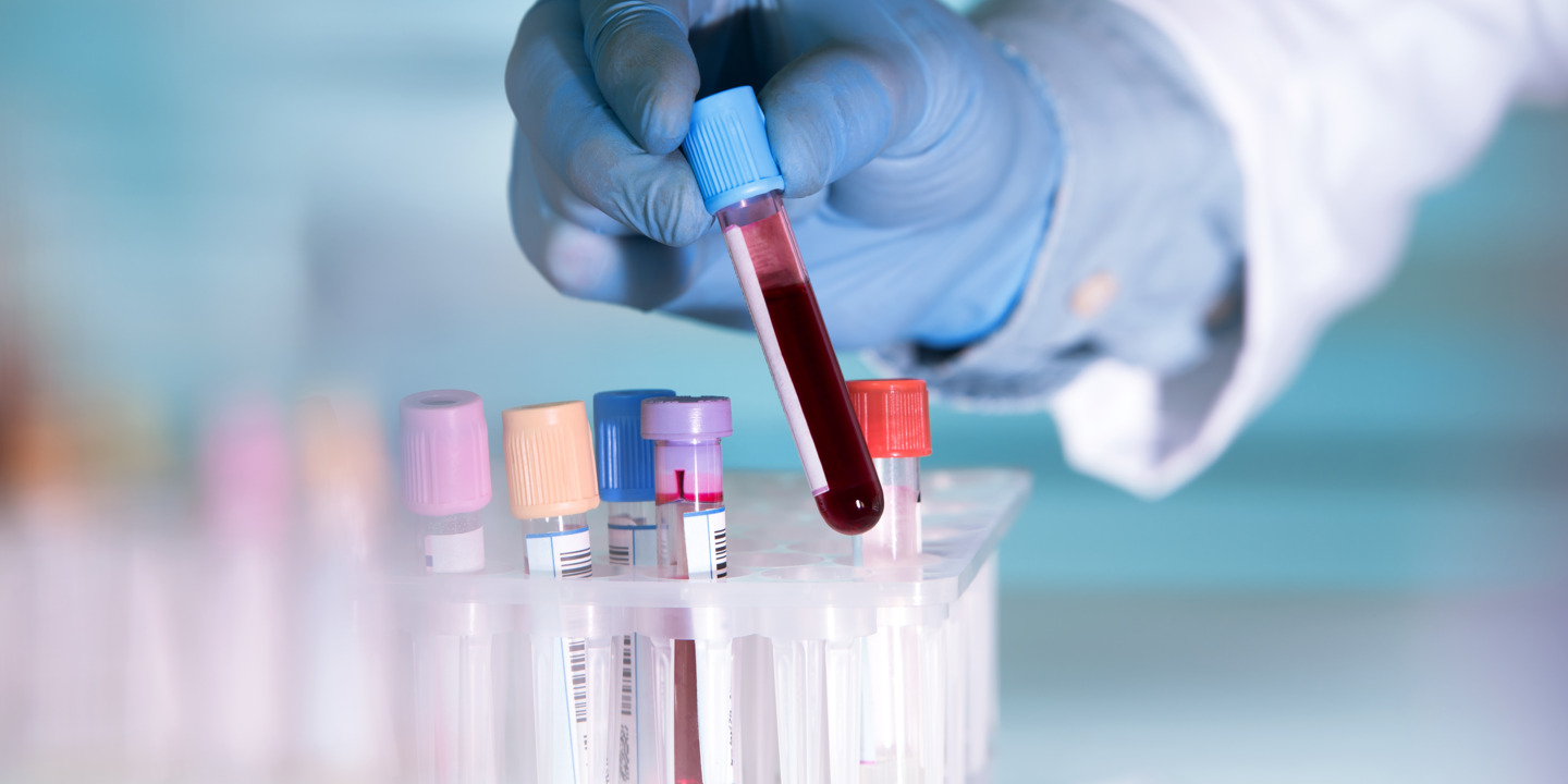 Mitarbeiter eines Labors hält eine Blutprobe in der Hand