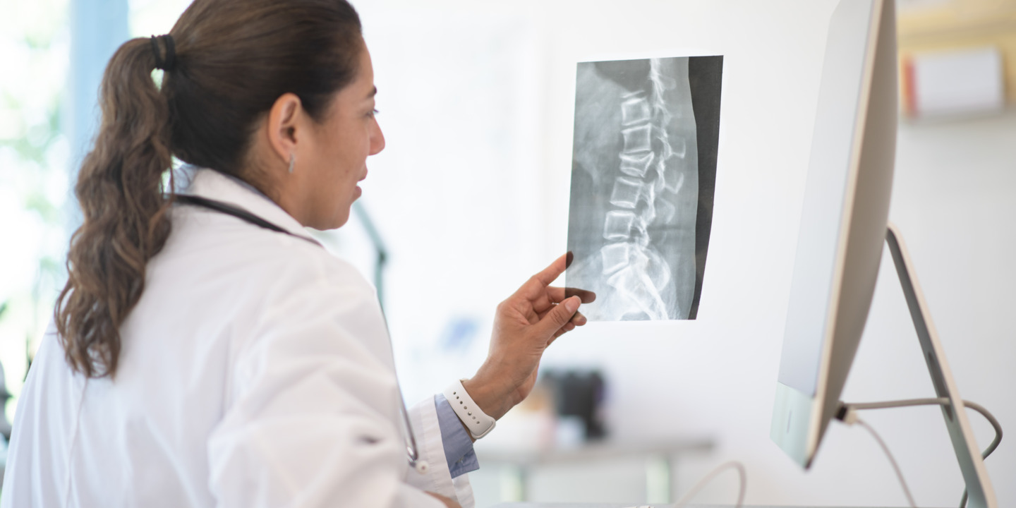 Ärztin betrachtet Röntgenaufnahme einer Wirbelsäule in Praxis