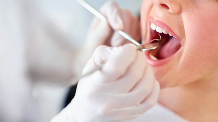 Kind mit offenem Mund beim Zahnarzt