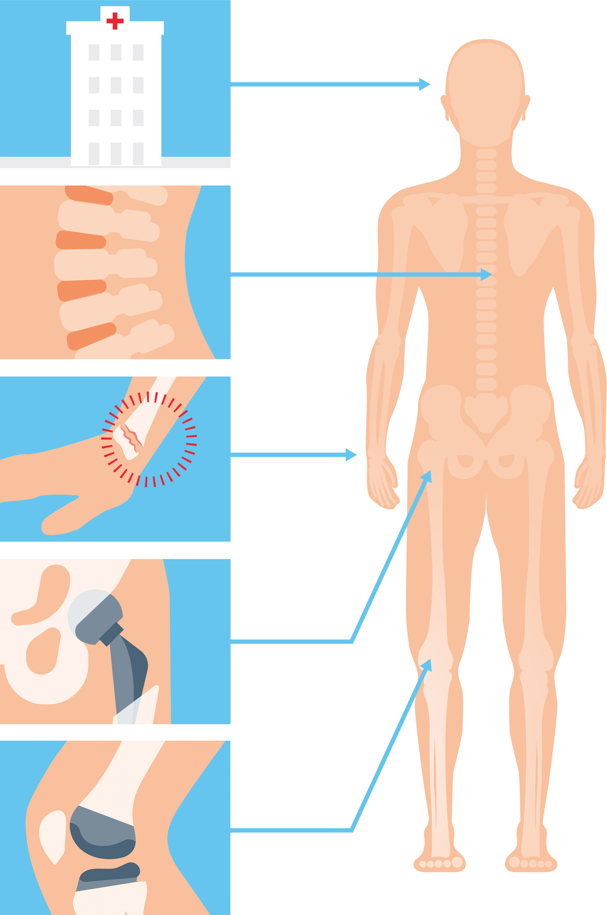 Infografik mit Beispiel eines menschlichen Körpers